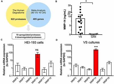 MMP-14 (MT1-MMP) Is a Biomarker of Surgical Outcome and a Potential Mediator of Hearing Loss in Patients With Vestibular Schwannomas
